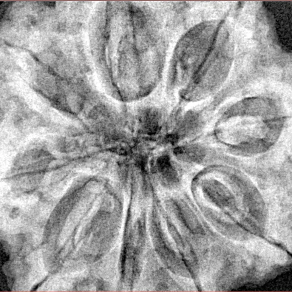 9 Mukhi Rudraksha 33.5mm 9.42gm - Xray