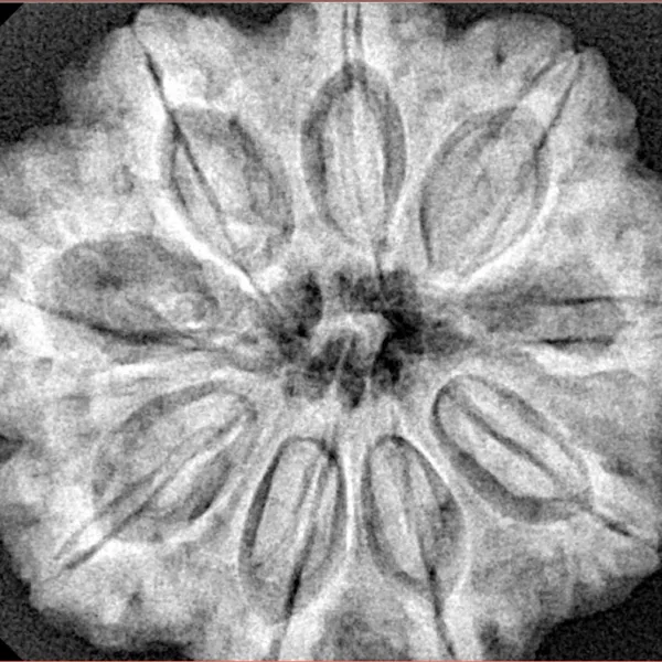 9 Mukhi Rudraksha 30.1mm 7.94gm - Xray