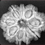 9 Mukhi Rudraksha 27.1mm 5.24gm - Xray