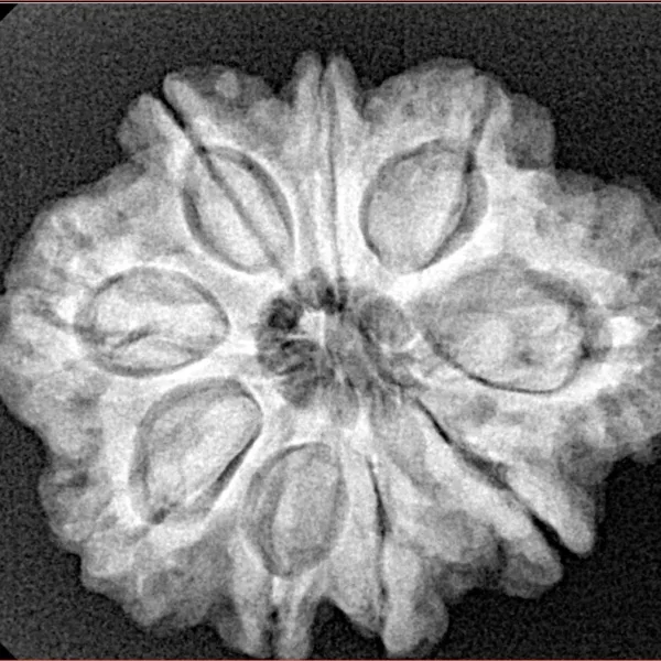 9 Mukhi Rudraksha 27.1mm 5.24gm - Xray