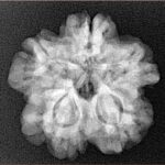 1MK(Underdeveloped) 23.2mm 4.15gm - Xray