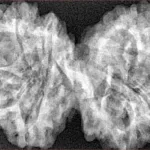 10 Mk Gaurishankar 40.6mm 7.79gm - Xray
