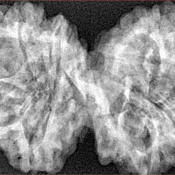 10 Mk Gaurishankar 40.6mm 7.79gm - Xray