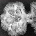 19 MK Gaurishankar 46.2mm 9.27gm - Xray