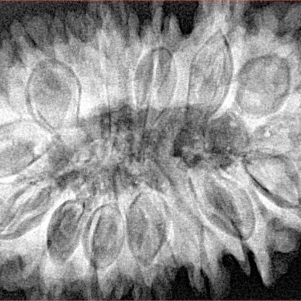 16 Mukhi Rudraksha 38.4mm 8.13gm - Xray