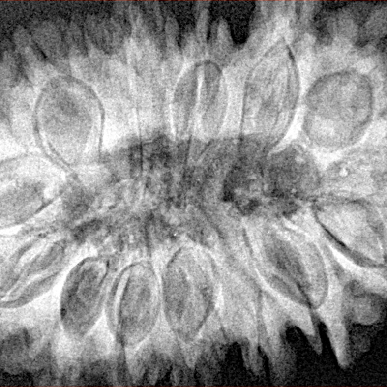 16 Mukhi Rudraksha 38.4mm 8.13gm - Xray