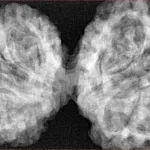 10 Mk Gaurishankar 44.6mm 9.98gm - Xray