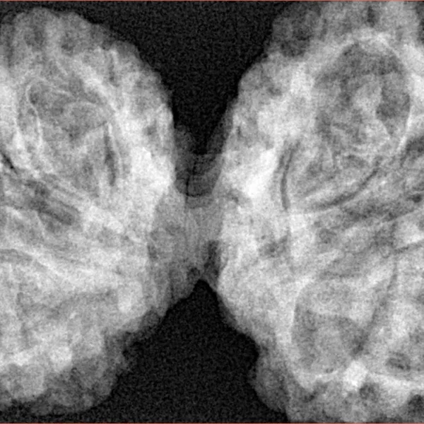 10 Mk Gaurishankar 44.6mm 9.98gm - Xray