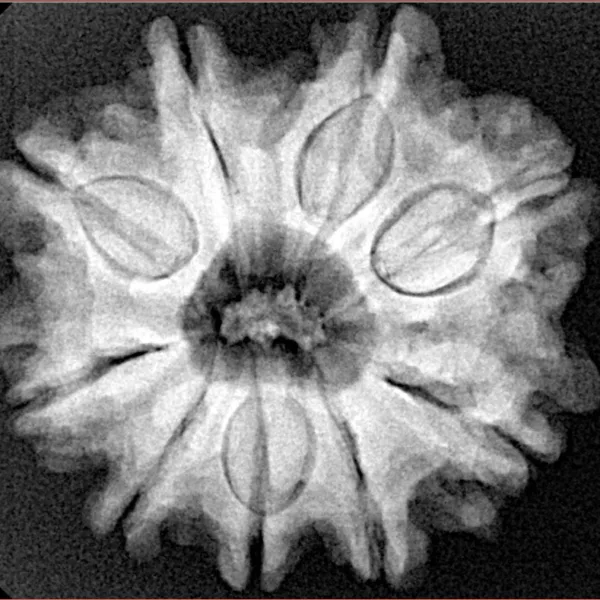 9 Mukhi Rudraksha 25.7mm 5.47gm - Xray