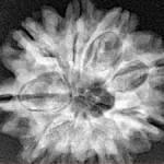 9 Mukhi Rudraksha 25mm 4.12gm - Xray