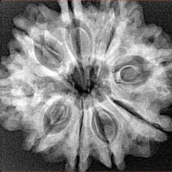 9 Mukhi Rudraksha 28.1mm 4.4gm - Xray