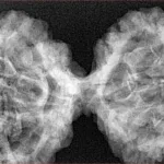 10 Mk Gaurishankar 43.6mm 8.39gm - Xray