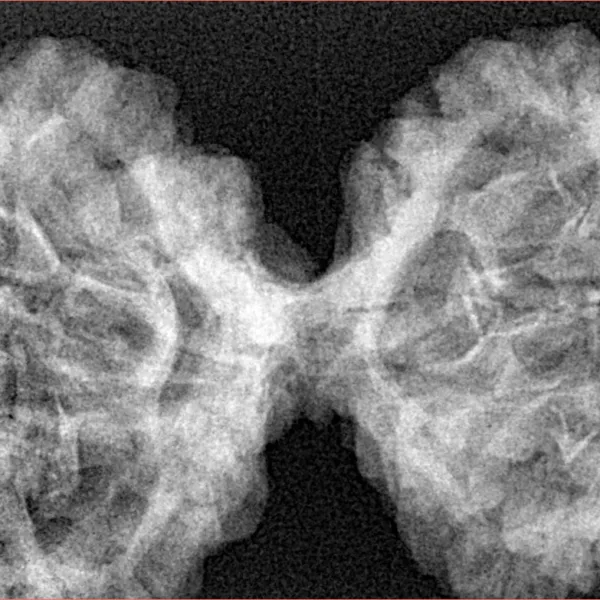 10 Mk Gaurishankar 43.6mm 8.39gm - Xray