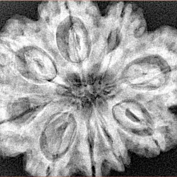 9 Mukhi Rudraksha 31.4mm 7.39gm - Xray