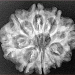 9 Mukhi Rudraksha 26mm 4.08gm - Xray
