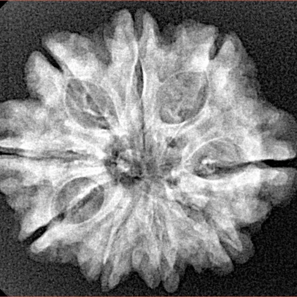 9 Mukhi Rudraksha 26.1mm 3.84gm - Xray