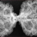 11 MK Gaurishankar 43.7mm 9.18gm - Xray