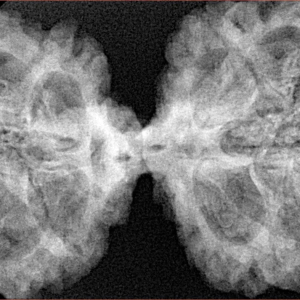 11 MK Gaurishankar 43.7mm 9.18gm - Xray