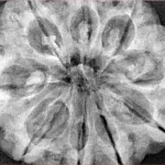 9 Mukhi Rudraksha 33.9mm 8.36gm - Xray