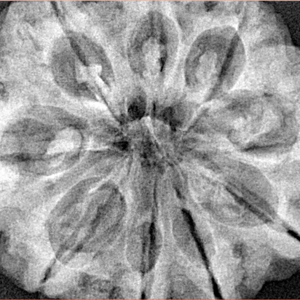 9 Mukhi Rudraksha 33.9mm 8.36gm - Xray