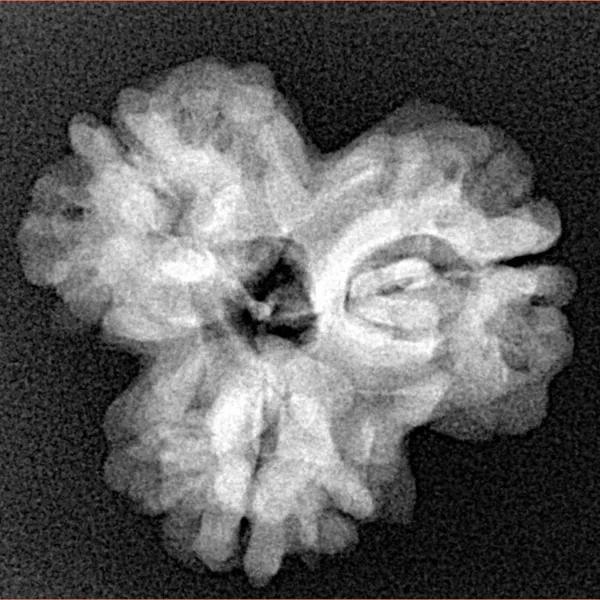 3 Mukhi Rudraksha 23.8mm 3.47gm - Xray