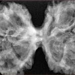 11 MK Gaurishankar 44.5mm 9.85gm - Xray