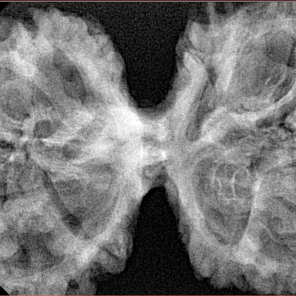 11 MK Gaurishankar 44.5mm 9.85gm - Xray