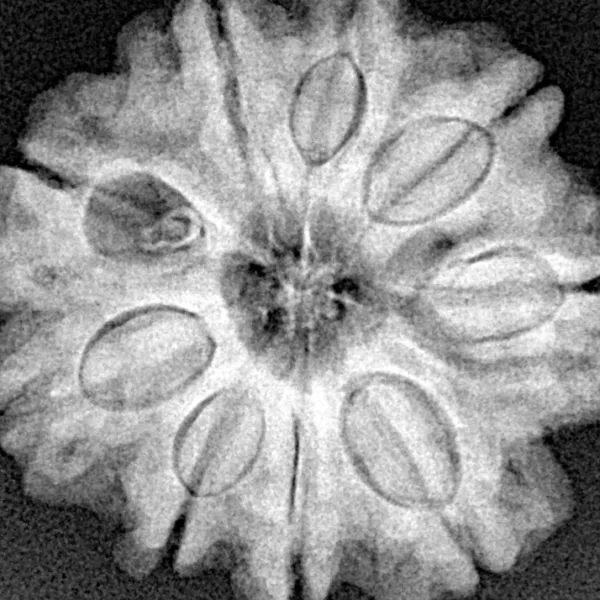 9 Mukhi Rudraksha 25.9mm 5.41gm - Xray