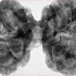 10 Mk Gaurishankar 42.7mm 10.98gm - Origin: Nepal - Inverse xray