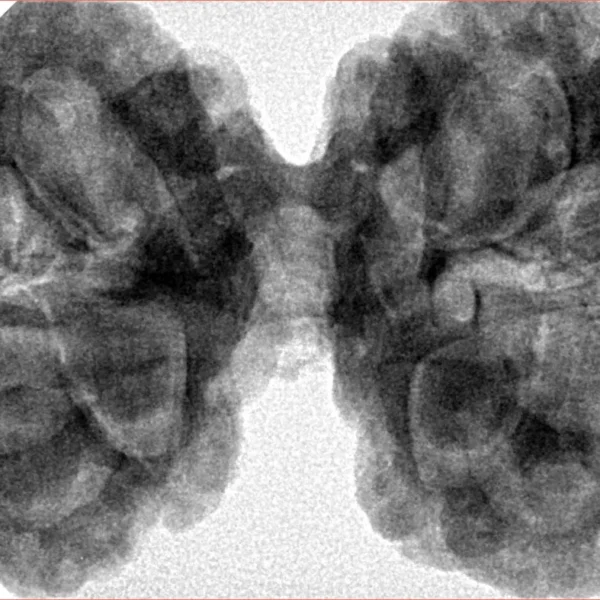10 Mk Gaurishankar 42.7mm 10.98gm - Origin: Nepal - Inverse xray