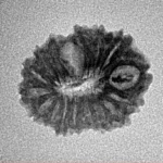 17 Mukhi Rudraksha 19.2mm 1.38gm - Inverse xray