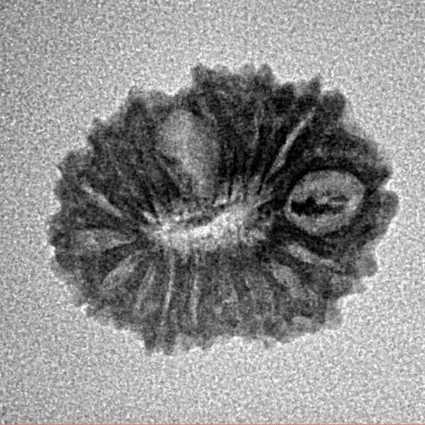 17 Mukhi Rudraksha 19.2mm 1.38gm - Inverse xray