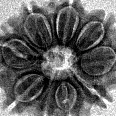 9 Mukhi Rudraksha 18.9mm 2gm - Inverse xray