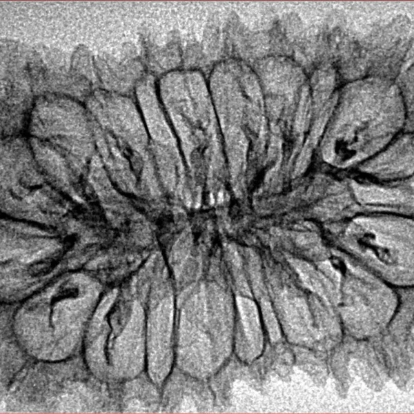 20 Mukhi Rudraksha 37.9mm 3.85gm - Inverse xray