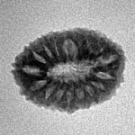 17 Mukhi Rudraksha 18.4mm 1.35gm - Inverse xray