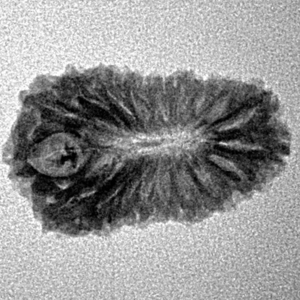 18 Mukhi Rudraksha 22.4mm 1.62gm - Inverse xray