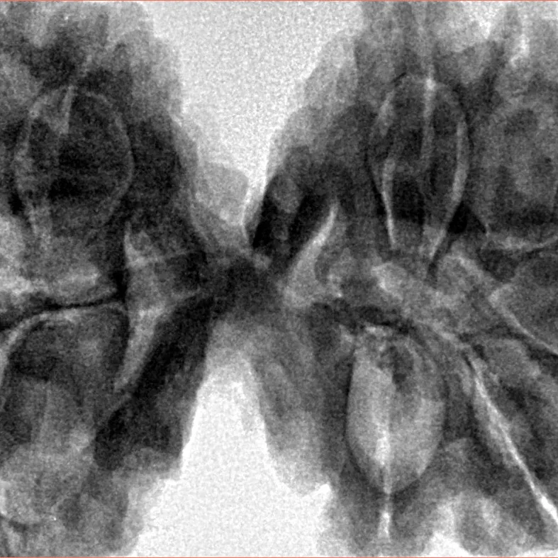 10 Mk Gaurishankar 43mm 11.74gm - Inverse xray