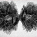 12 MK Gaurishankar 36.5mm 7.12gm - Inverse xray