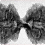 9 MK Gaurishankar 40.8mm 8.83gm - Inverse xray