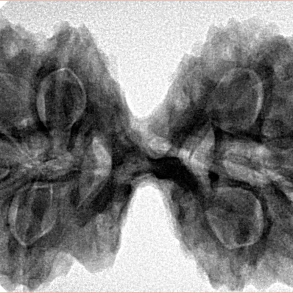 9 MK Gaurishankar 40.8mm 8.83gm - Inverse xray