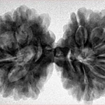 10 Mk Gaurishankar 37.1mm 7.33gm - Inverse xray