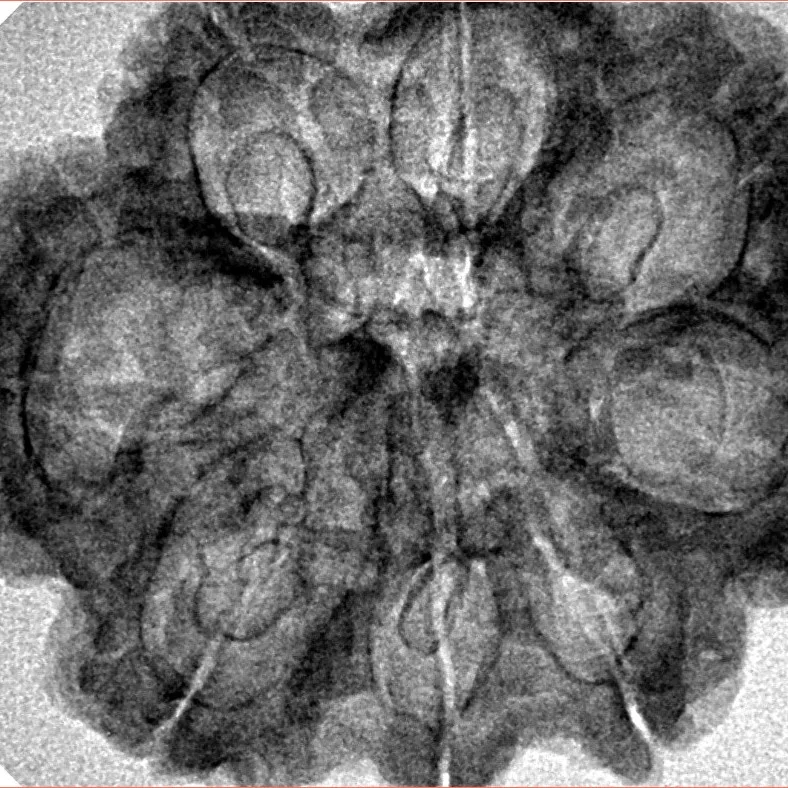 8 Mukhi Rudraksha 30.6mm 5.18gm - Inverse xray