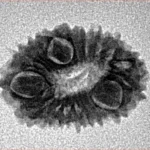 16 Mukhi Rudraksha 18.5mm 1.24gm - Inverse xray