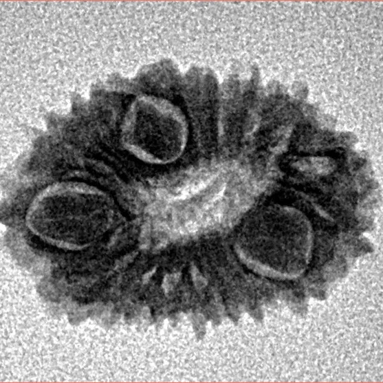 16 Mukhi Rudraksha 18.5mm 1.24gm - Inverse xray