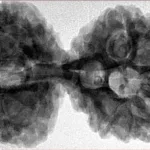 11 MK Gaurishankar 42.4mm 9.82gm - Inverse xray