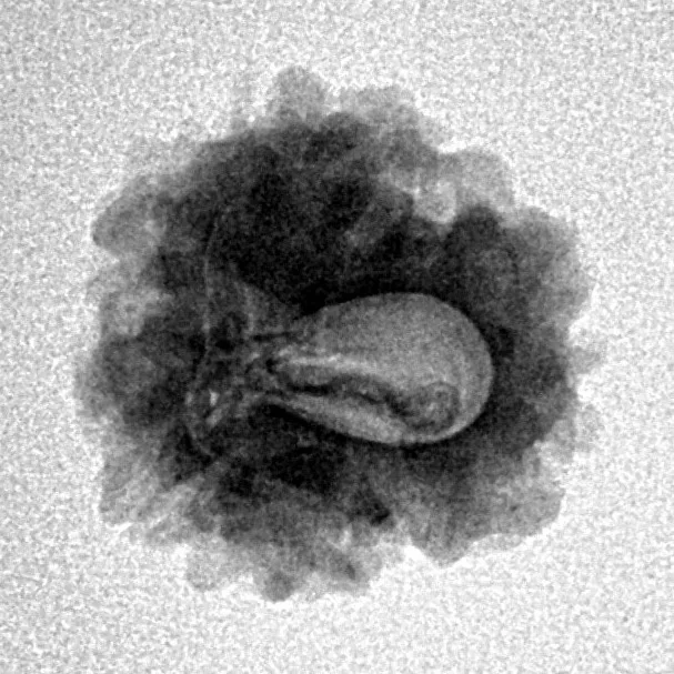1 Mukhi Rudraksha 18.6mm 1.91gm - Inverse xray
