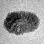 17 Mukhi Rudraksha 18.4mm 1.2gm - Inverse xray