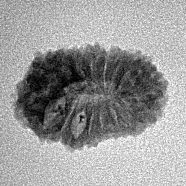 17 Mukhi Rudraksha 18.4mm 1.2gm - Inverse xray