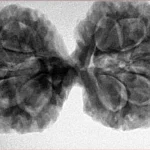 11 MK Gaurishankar 38mm 7.58gm - Inverse xray