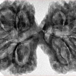 10 Mk Gaurishankar 40.4mm 8.99gm - Inverse xray